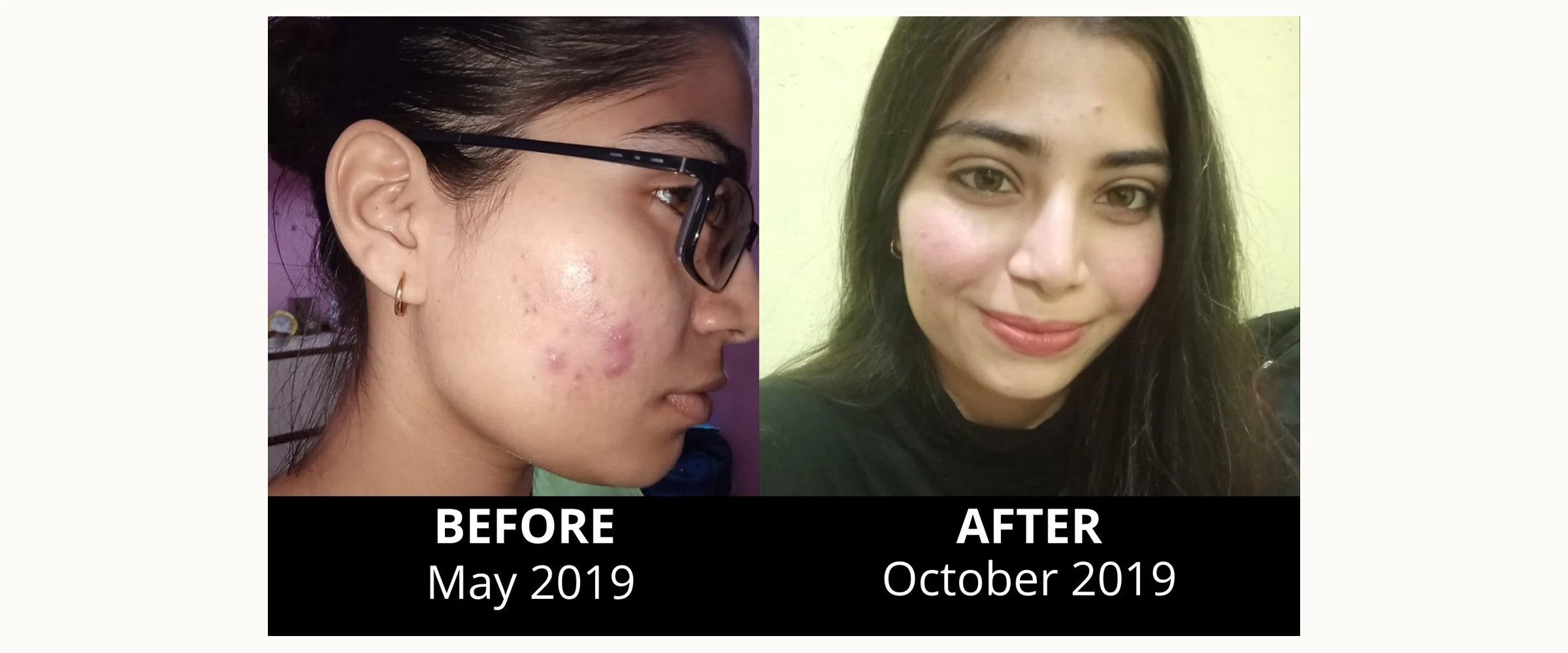 Annanya before (May 2019) and after (October 2019) following the Satvic lifestyle